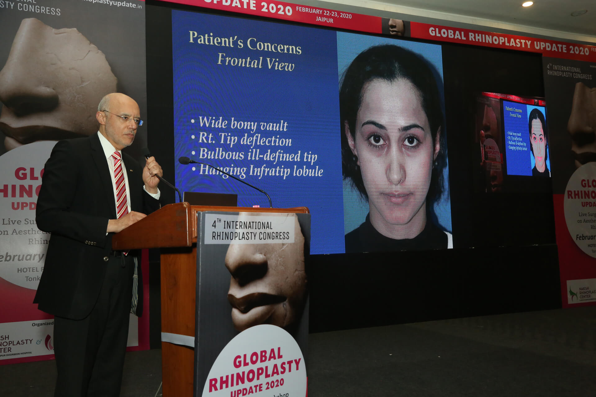 4th International Rhinoplasty Congress