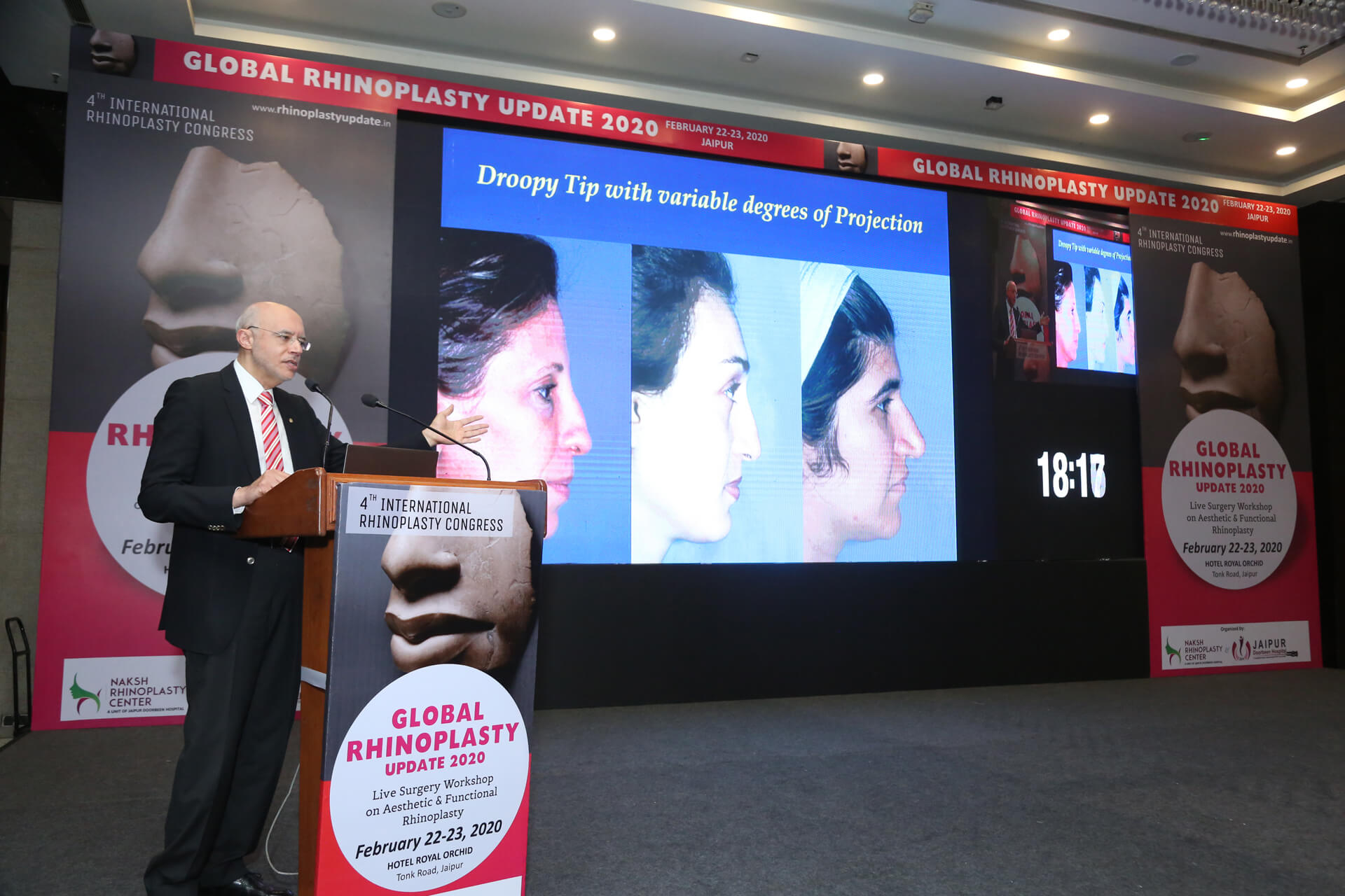 4th International Rhinoplasty Congress