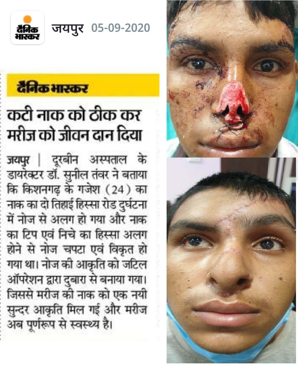 Media Coverage